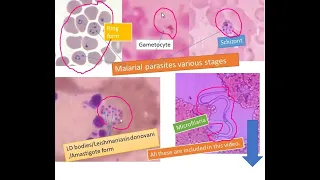 Most common Blood parasites