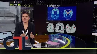 OTL responds to NFL concussion coverage claims | Outside The Lines | ESPN