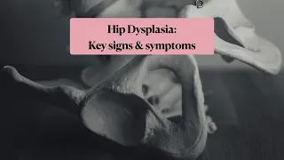 Hip dysplasia key signs and symptoms