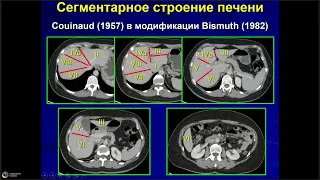 Нормальная и вариантная анатомия печени, желчевыводящих путей и сосудов