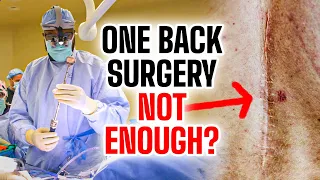 Here is Why Patients Need Multiple Back Surgeries...