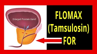 How to take Tamsulosin (Flomax) | All you Need to Know | Enlarged Prostate