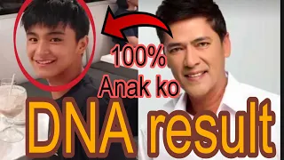 DNA test result lumabas na! Vic Sotto and Julia Clarete's Son revealed!