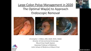 Large Colon Polyp Management in 2020: The Optimal Way(e) to Approach Endoscopic Removal