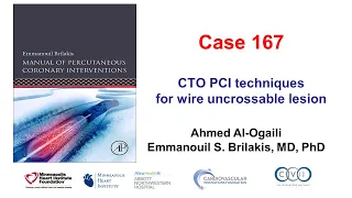 Case 167: Manual of PCI - CTO PCI techniques for a wire uncrossable lesion