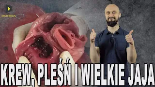 Krew, pleśń i wielkie jaja - przełomy w medycynie. Historia Bez Cenzury