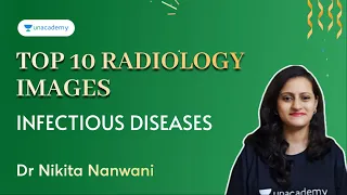 Top 10 Radiology images - Infectious diseases | NEET PG 2022 | Dr Nikita Nanwani