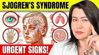 10 Vital Signs of Sjogren's Syndrome You Can't Ignore