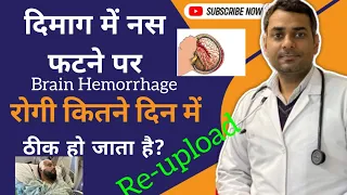 dimag ki nas fatna | Brain Hemorrhage in hindi | दिमाग की नस फटना, कितने टाइम में ठीक हो जाता है