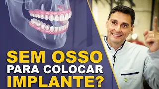 Sem Dentes na Parte Debaixo? Veja Como Recuperar Com Implantes e Sem Enxerto