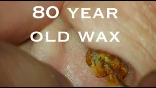 80 yr OLD WAX : I NEVER CLEANED MY EARS : 4K/HD