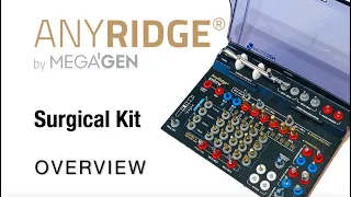 The New AnyRidge Sx Kit Overview