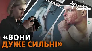 Українські військові, тіла яких понівечила війна, в об'єктиві фотографині зі Львова