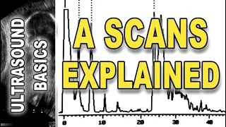 ultrasound - A scans explained