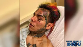 Tekashi 6ix9ine pistol whipped, kidnapped and robbed in Brooklyn (NYC)