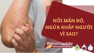 Nguyên nhân gây ra tình trạng nổi mẩn đỏ, ngứa khắp người là gì?