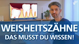 Weisheitszähne - Das musst du wissen! Das passiert in deinem Mund!