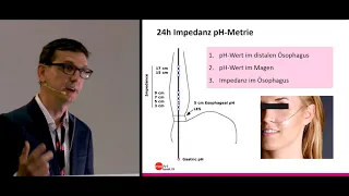 medArt 2019:  Dienstag 05 E Burri Refluxkrankheit