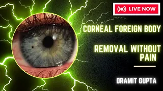 Painless Corneal Foreign body Removal