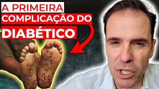 NEUROPATIA, A PRIMEIRA COMPLICAÇÃO PARA VOCÊ DIABÉTICO