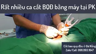 Cắt bao quy đầu bằng máy ở Đà Nẵng – Ca xử lý dài bao quy đầu cho bệnh nhân.