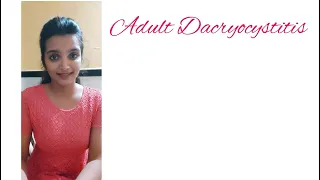 Adult dacryocystitis (Dacryocystitis part -3) A K Khurana