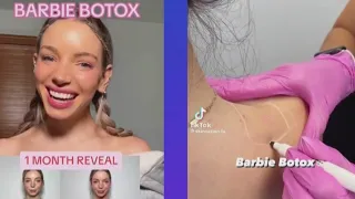 Influencer slammed for promoting 'Barbie Botox' trend