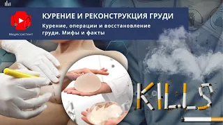 Курение, хирургические операции и реконструкция груди. Мифы и факты