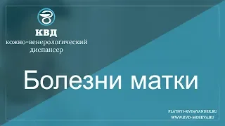 727  Болезни матки