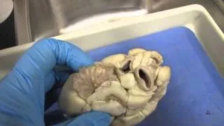 Sheep Heart External Examination