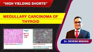 High Yielding Shorts-70 (#HYS-70): Medullary  carcinoma of Thyroid by Dr. Devesh Mishra.