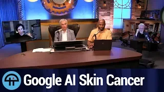 Google Uses AI to Diagnose Skin Cancer