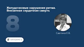 Желудочковые нарушения ритма. Внезапная сердечная смерть. 15.02.23