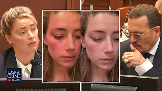 Johnny Depp's Lawyer Notes Differences in Injury Photos From Amber Heard