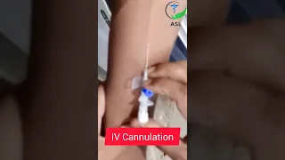 I.V. Cannulation technique #youtubeshorts #shortvideo #viralvideo #trending #medical #cannula #new