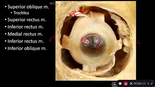 Orbit& Eye - Extra-ocular Muscles (Anterior Approach)