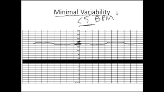 NonStress Test Made Simple