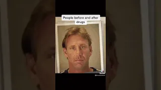 People before and after drugs😳 | (TikTok Compilation) #shorts