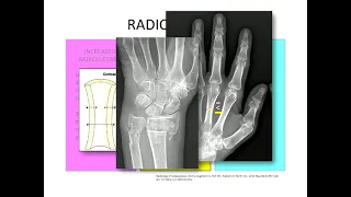 Imaging  of Osteoporosis