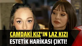 Camdaki Kız’ın Laz Kızı estetik harikası çıktı! Şarkıcı Alya'nın eski hali şoke etti!