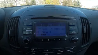 How to Activate Auto Store Radio Feature in Hyundai i30 I ( 2007 – 2012 )