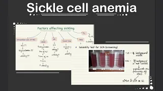 Sickle Cell Anemia | Pathology | Full Revision with Easy Notes