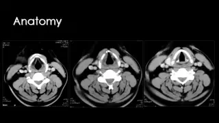 Imaging of Larynx Sep 2013   Dr Mamdouh Mahfouz In Arabic