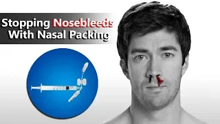 Stopping Nosebleeds With Nasal Packing