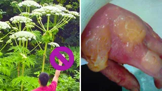 The Most Dangerous Plants in the World