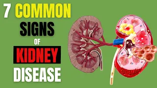 KIDNEY DISEASE| KIDNEY FAILURE: 7 EARLY SIGNS YOU SHOULD NOT IGNORE