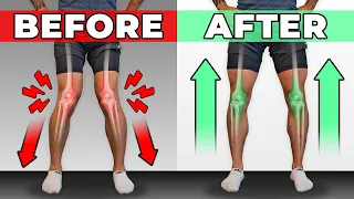 How To Unf*ck Your Knees in 10 Minutes/Day (CORRECTIVE ROUTINE)