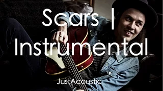 Scars - James Bay (Acoustic Instrumental)