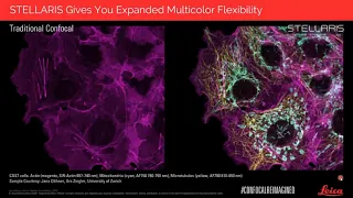 Get Closer to the Truth STELLARIS   Confocal Re Imagined