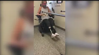 Poland woman who lost limbs to flu complications gets fitted for new prosthetic legs